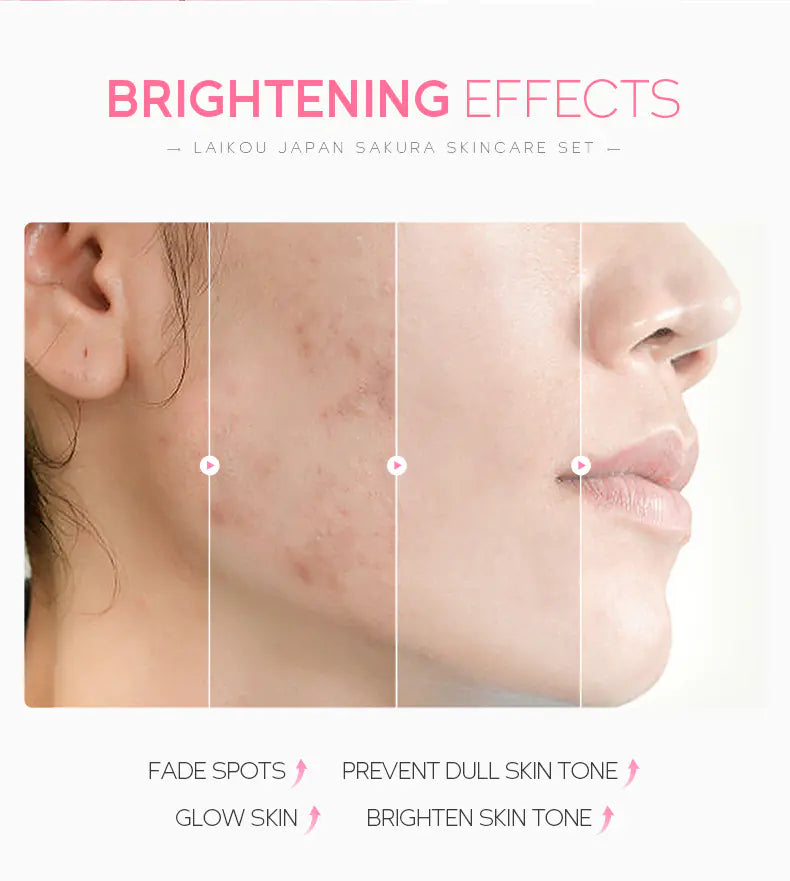 Hydrating Face Cream 5 Piece Skincare Set